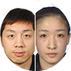 许昕/刘诗雯